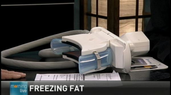 Freezing away fat