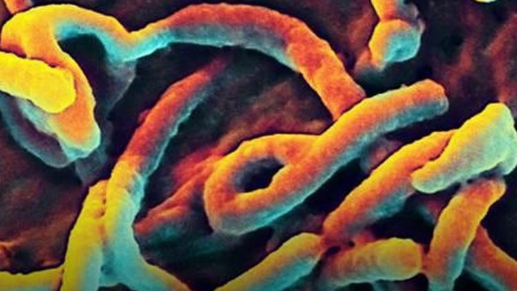 The Ebola virus (file)