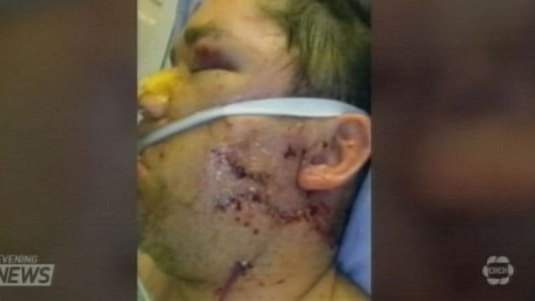 A vicious attack in a downtown bar has left a 43-year old St. Catharines man in hospital