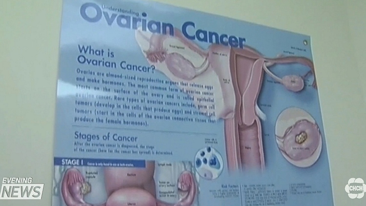 Ovarian cancer test