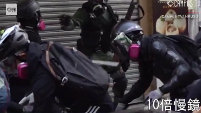 Hong Kong protester shot with live round