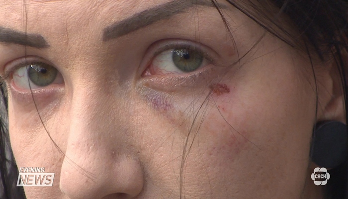 Woman claims she was assaulted by police in Hess Village, SIU now investigating