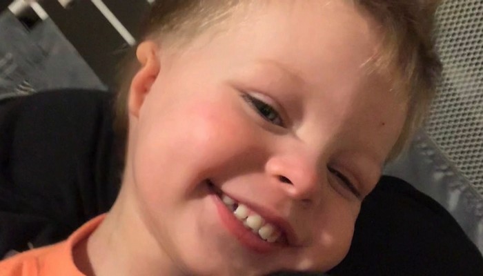 Three-year-old Pelham boy to have surgery in California to build his right ear