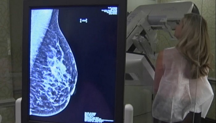 breast cancer