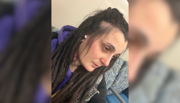 Hate-motivated attack Hamilton