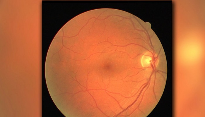 eye health research